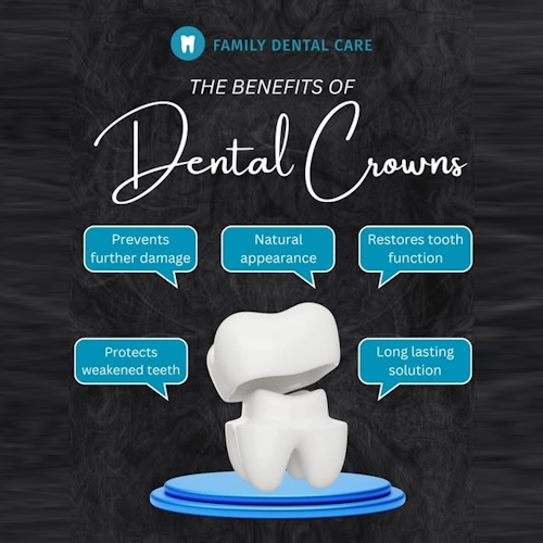 dental crown hilton family dental